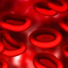 Bloedafwijking: teveel rode bloedcellen