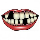 Parodontitis: ontsteking van tandvlees rondom de tanden