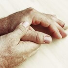 Tintelende duim, wijsvinger of middelvinger: zenuwbeknelling