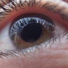 Herpes in het oog (oculaire herpes of oogherpes)