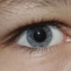 Leukocorie: Witte pupilreflex in het oog