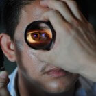 Oftalmoscopie (fundoscopie): Onderzoek achterkant van oog