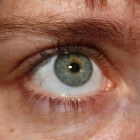 Droge ogen syndroom: Oogimplantaat maakt tranen bij patiënt