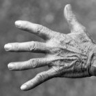 Stramme, pijnlijke handen: oorzaken van stijve, stramme hand