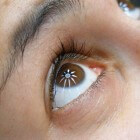 Pijn aan de ogen of oogpijn: oorzaken van pijnlijke ogen
