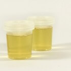 Heldere urine: Oorzaken van waterachtige, transparante urine
