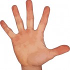Jersey vinger: Scheur in buigpees van vinger met pijn