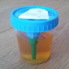 Troebele urine: oorzaken troebele plas met een sterke geur