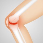 Scheur in de meniscus: operatie of niet?