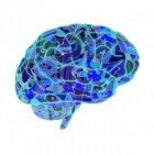 Subduraal hematoom: Bloeding onder schedel, buiten hersenen