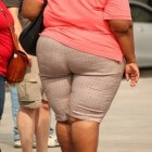 Obesitas (zwaarlijvigheid): Risicofactoren voor overgewicht