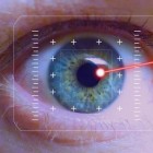 Lasercoagulatie oog: Behandeling van abnormale bloedvaten