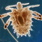 Schaamluis, platjes: symptomen, klachten en behandeling