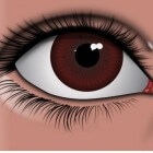 Oogaandoening: Zwelling van het ooglid (Chalazion)