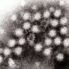 Buikgriep door norovirus: symptomen, oorzaak en behandeling