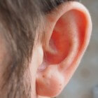 Beschadiging buitenkant van het oor: bloemkooloor
