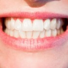 Wittere tanden zonder te bleken of facings aan te brengen