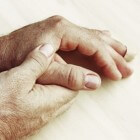 Wat te doen bij artrose: bewegen en gewrichten beschermen