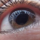 Fotodynamische laserbehandeling van het oog met Visudyne