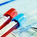 HbA1c-test: normaalwaarde HbA1c bij volwassenen en kinderen