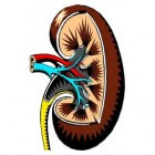 Nierbiopsie: Wegnemen van weefselmonster nier (nierbiopt)