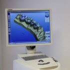 Cerec 3D CAD/CAM Systeem