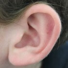 Eenvoudige tips tegen oorpijn