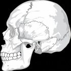 Syndroom van Crouzon: vroegtijdige samengroei schedel