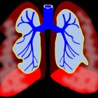 Astma: diagnose, tips en medicijnen (inhalatorgebruik)