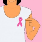 DCIS: voorstadium van borstkanker maar nog geen kanker