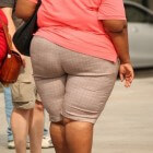 Ernstig overgewicht: morbide obesitas