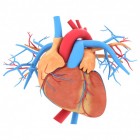 Harttamponade een levensbedreigende overdruk op het hart