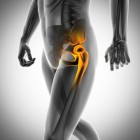 Pijnlijke zijkant bovenbeen en bips: trochanter ontsteking