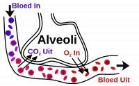 Schematische weergave onderbreking bloedsomloop door longembolie.<BR>
1) Normaal aanbod aan alveoli<BR>
2) Onderbreking aanbod zuurstofarm bloed door embolie / Bron: Helix84, Wikimedia Commons (CC BY-SA-3.0)