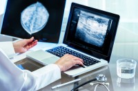 Een radioloog beoordeelt de foto (mammografie) / Bron: Karelnoppe/Shutterstock.nl