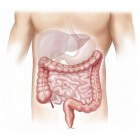 Darmperforatie: oorzaken en behandeling geperforeerde darm