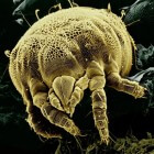 Besmetting met parasieten door voeding