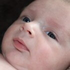 Braken bij baby's: pylorusstenose (vernauwde maaguitgang)