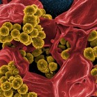Klebsiella bacterie is gevaarlijk vanwege besmetting