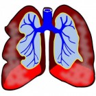 Salbutamol: een medicijn bij astma en COPD