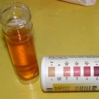Nitrofurantoïne: medicijn tegen urineweginfecties