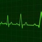 Dreigend hartinfarct – de eerste signalen