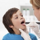 Knobbeltje onder de tong: oorzaken van een bultje onder tong