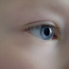 Corneatopografie: Onderzoek - Beeld van hoornvlies van oog