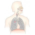 Bronchoscopie: Inwendig kijkonderzoek luchtwegen (longen)