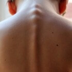 Spinale tumoren in ruggenmerg: Symptomen en behandeling