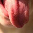 Rode tong: Oorzaken en symptomen van rode tongkleur