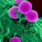 Agammaglobulinemie: Infecties door tekort aan antistoffen