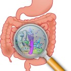 Bacteriële overgroei in dunne darm: Darmproblemen