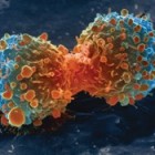 Uitzaaiingen kanker in longen: behandeling longmetastasen